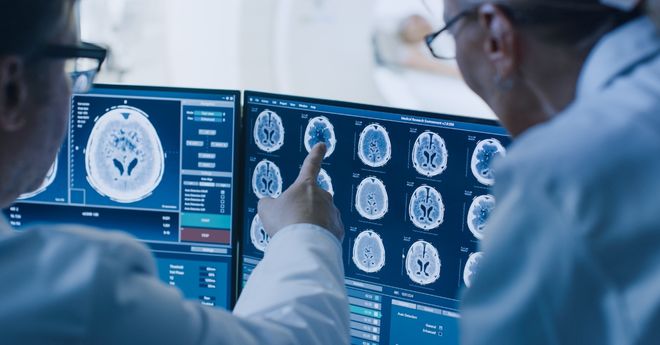 Multiple views of a scanned brain on a digital display screen.